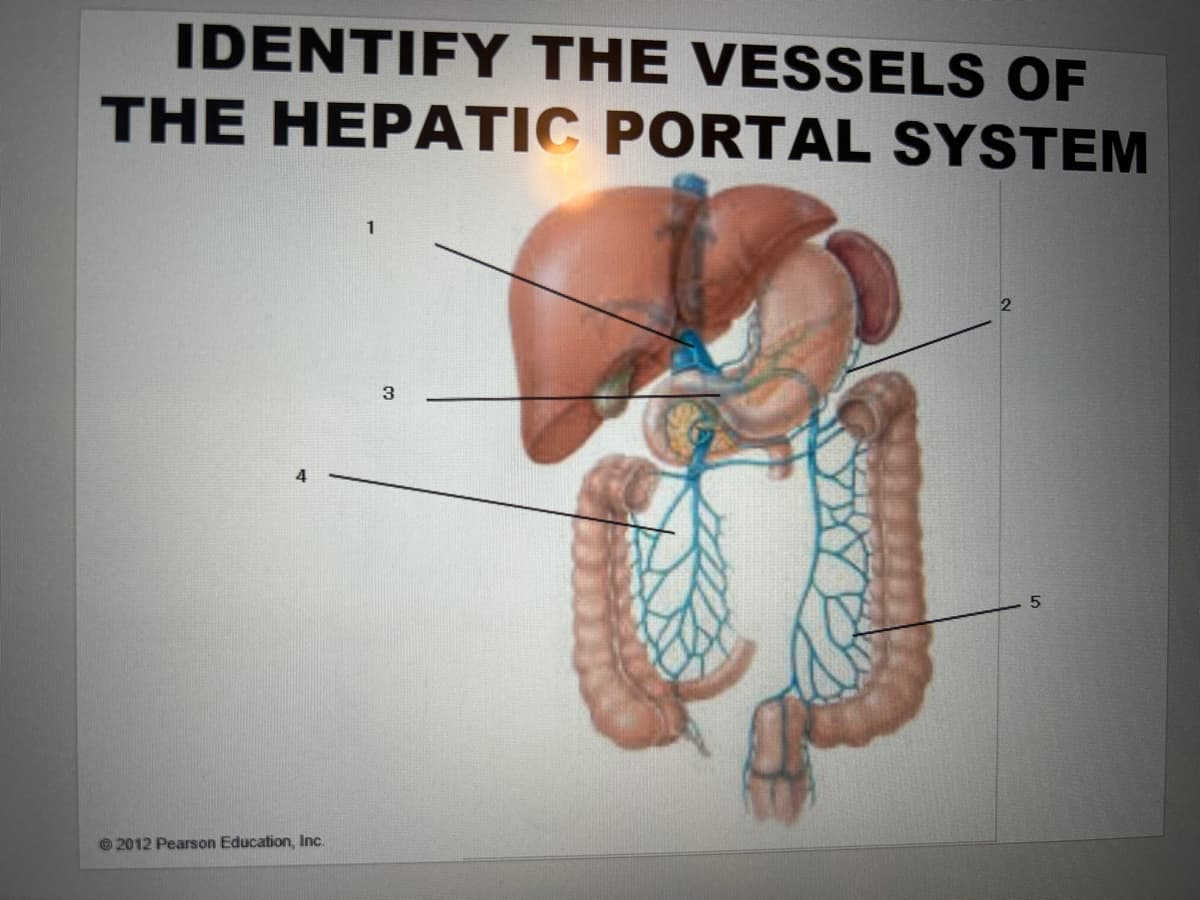 IDENTIFY THE VESSELS OF
THE HEPATIC PORTAL SYSTEM
4
2012 Pearson Education, Inc.
1
3
5